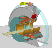 Huidige marges MR-Linac PTV