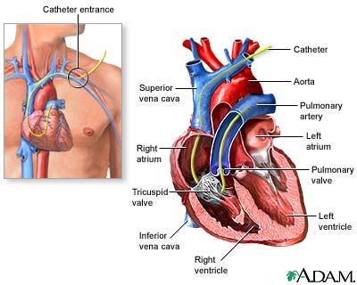 CVD BEWAKING OP IC CVD Centrale veneuze catheter Swan ganz catheter 37 38 CVD TE DIEP / SG VRAAGJE Wat is een normale CVD? Wat zijn de oorzaken van een lage CVD? Wat zijn de oorzaken van een hoge CVD?