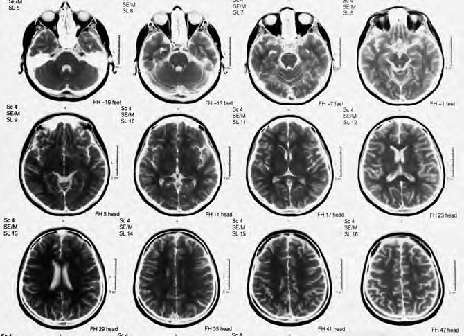 Mri-scans van hersenen in de filosofische literatuur vooral de eerste en derde categorie, en dan met name de derde categorie, aandacht hebben gekregen, wil ik hier één argument uit de eerste