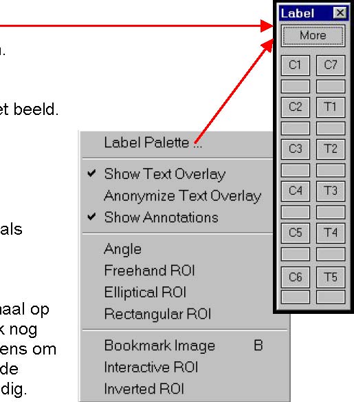 Bijkomende toolbox onder TOOLS: LABEL PALETTE : Laat toe om via een nieuw venstertje de verschillende wervels gemakkelijk te benoemen.