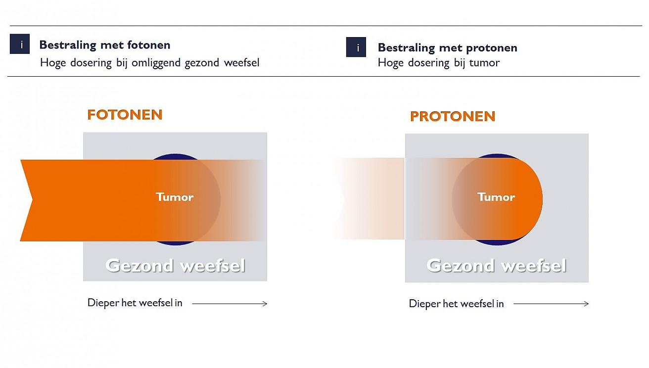 Protonentherapie is erg duur, de businesscases van de centra gaan uit van optimistische aantallen te behandelen patiënten en dito gezondheidswinsten.