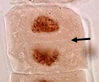 1. Profase (pro = voor): de voorbereidingsfase.