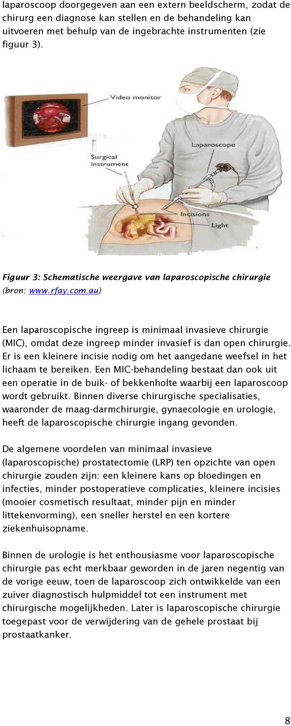 au) Een laparoscopische ingreep is minimaal invasieve chirurgie (MIC), omdat deze ingreep minder invasief is dan open chirurgie.
