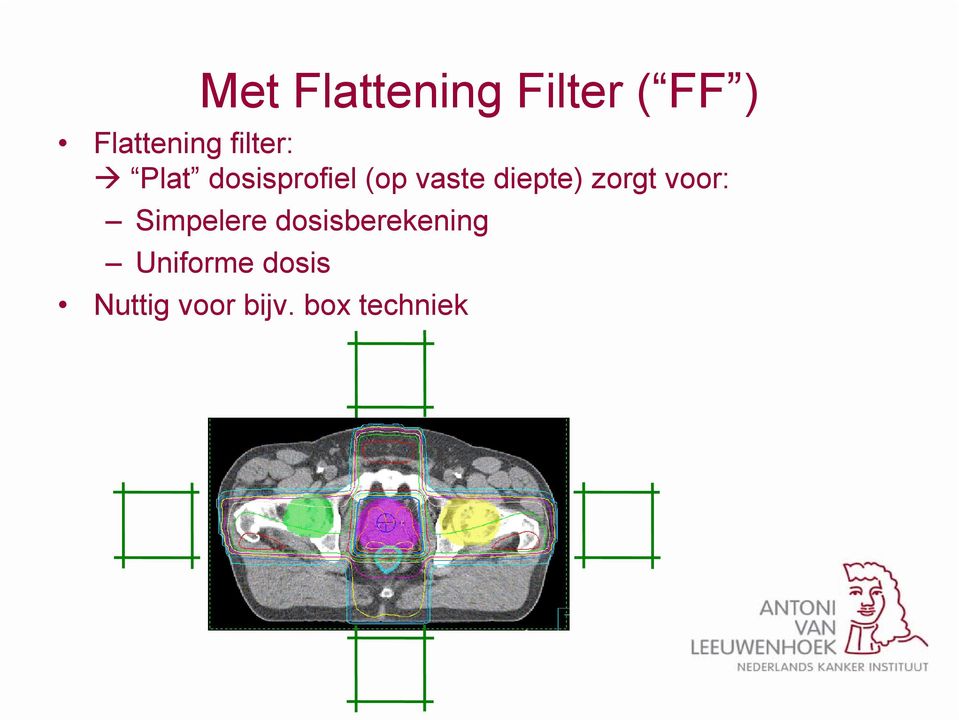 diepte) zorgt voor: Simpelere