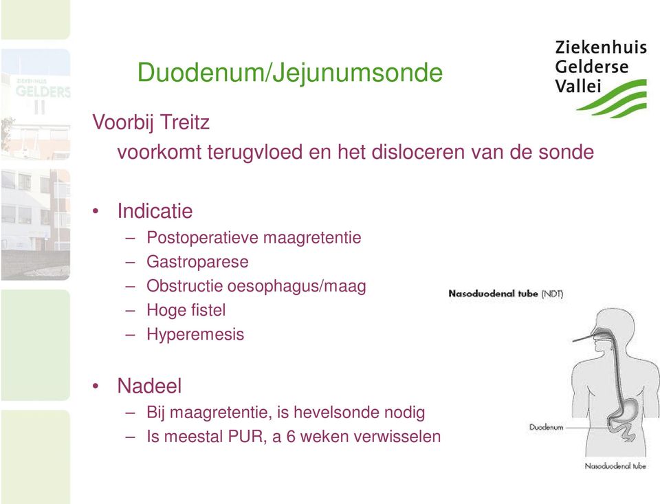 Gastroparese Obstructie oesophagus/maag Hoge fistel Hyperemesis