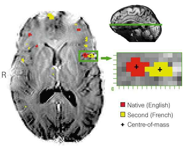 Late vs. Early bilinguals (Kim et al.