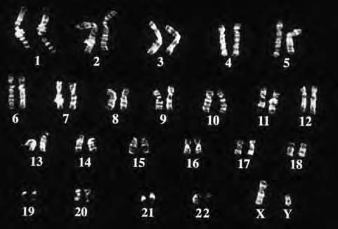 Lewe op molekulêre, sellulêre en weefselvlak Eenheid 1 Chromosome Oorsig van chromosome kariotipe: n geordende vertoning van al die chromosome wat in n selkern aangetref word outosoom: n chromosoom
