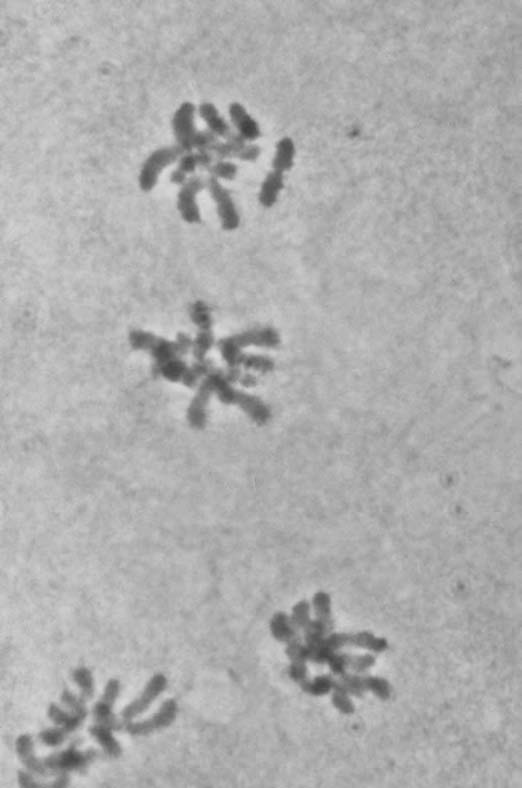 Anafase II o Die sentromere verdeel en die chromatiede skei. Die individuele chromosome, wat dogterchromosome genoem word, beweeg na teenoorgestelde pole van die spoel. Fig. 2.