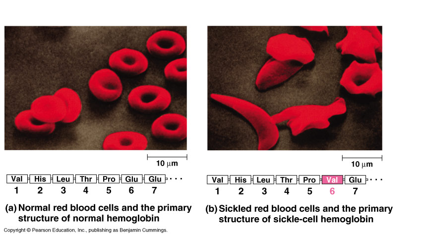 Bijlage Vraag F-5 Sikkelcellen In onderstaande figuur zijn rode bloedcellen weergegeven. In figuur (a) hebben we te maken met normaal hemoglobine.