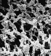 De polymeermembranen worden vooral vervaardigd uit cellulose acetaat, polysulfon en nylon. De cellulose membranen zijn de grootste groep en ook de goedkoopste (Barret and Atkinson 2004).