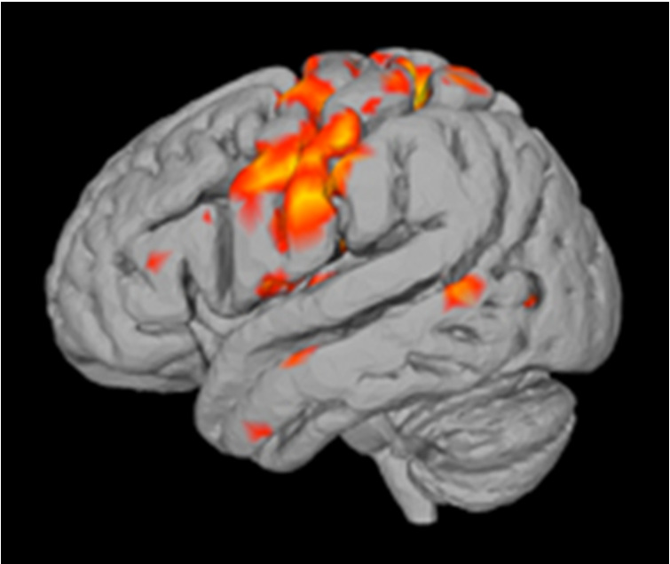 Veelgebruikte technieken van neuromarketing CIC 26 A. EEG (meet elektrische activiteit). B.