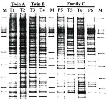 «des facteurs liés au génotype de l hôte seraient des déterminants majeurs de la composition du microbiote intestinal» E. Zoetendal et al. 2001 MEHD 13:129-134.