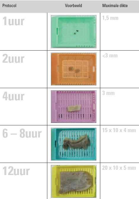 Technische mogelijkheden MDO 16.00 uur verslaglegging: 30 min. Beoordelen patholoog: 10 min. Beoordeling assistent: 20 min. Afplakken, sorteren e.d.: 10 min. Kleuren: 40 min.