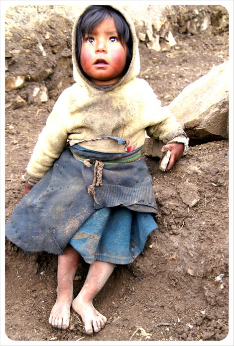 1 nieuwsbrief november 2011 WAAROM OOK AL WEER? In de gebieden waar wij werken is één op de drie kinderen chronisch ondervoed.