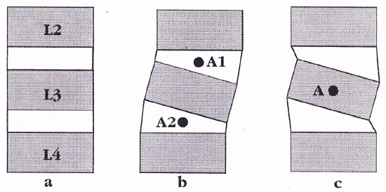 In figuur 4b is een lateraalflexie naar rechts opgetreden tussen L3 en L4 van 8. White en Panjabi (1) vermelden waarden voor de lateraalflexie per lumbale wervel tussen 4 en 8. Figuur 4. a.