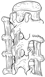 14 De romp 15 De andere vertebrale ligamenten zijn discontinu en verbinden de verschillende uitsteeksels van de wervels met elkaar. ; Figuur 2.29 Tussen twee laminae loopt het lig. flavum.