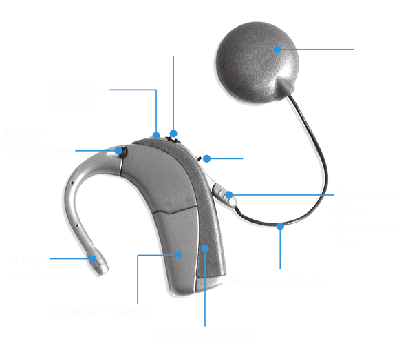 Deel I : Het in elkaar zetten van uw Auria Harmony processor Overzicht Uw cochleair implantaatsysteem bestaat uit een microfoon, Auria Harmony processor, zendspoel, kabel en implantaat.
