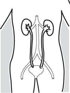 Inleiding De urineleider (ureter) Onderzoek heeft aangetoond dat er bij u een steen aanwezig is in de urineleider (ureter).