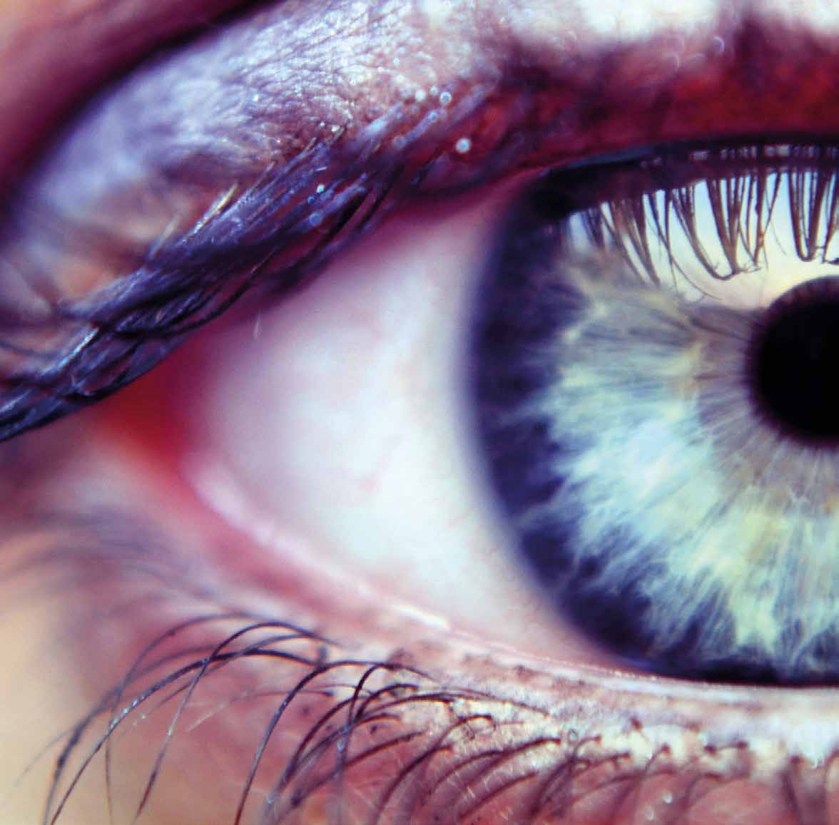 Tips voor gezonde ogen Signalen van een oogziekte Gezond eten voor je ogen