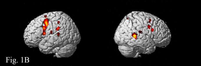 Resultaten Vergelijking liet zien dat de hersenactivaties in de linker hersenhelft bij beide groepen musici vrijwel gelijk waren.