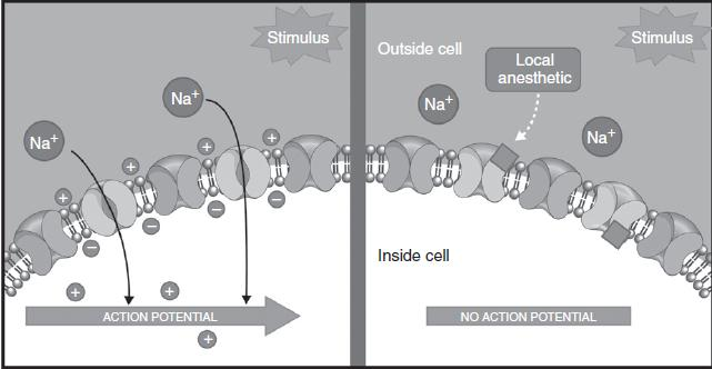 Perifeer Zenuwstelsel (1) Locale anesthetica Blokkade Na + -kanalen in neuronale membranen Lidocaine 5% pleister (Versatis ) Terugbetaling voor PHN Andere perifere neuropathische pijnsyndromen Naast