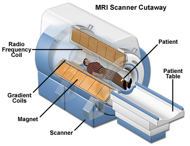 Ervaring 2 MRI; lekstroom in onbelaste toestand. Visualisatie Bekabeling 6/7 µa/mtr TR 35 µa Filter (Let op! Wandcontactdozen niet conform K2 regels.