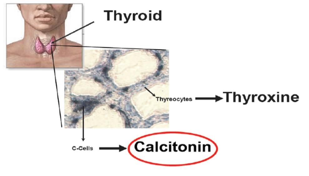 Procalcitonine PCT precursor van calcitonine PCT calcitonine geproduceerd in C-cellen van schildklier