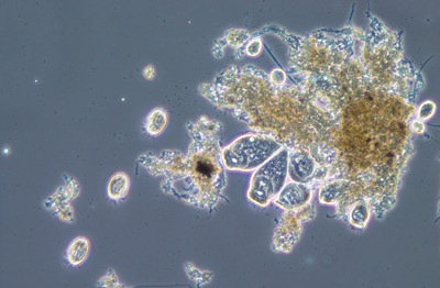 Micro-organismen vormen er een grote schoonmaakploeg Water-slibmengsel