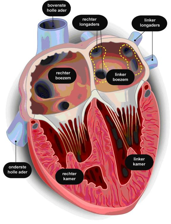 http://nl.ecgpedia.org/wiki/bestand:coronary_anatomy.