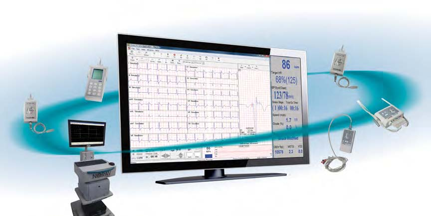 Rust ECG PC-Based ECG Norav ECG systemen zijn gunstig geprijsd, gemakkelijk te bedienen en van hoogwaardige kwaliteit.