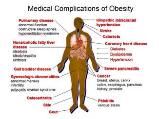 obesitas Implicaties 