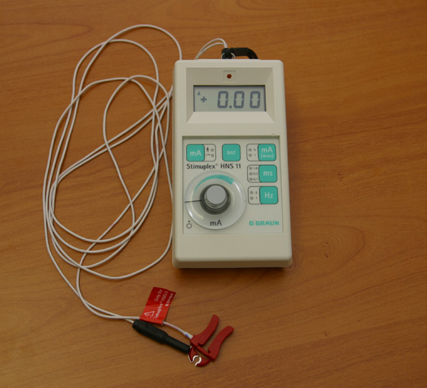 Door gebruik te maken van kleine elektrische schokjes kan de anesthesist de exacte positie van de zenuw opzoeken.