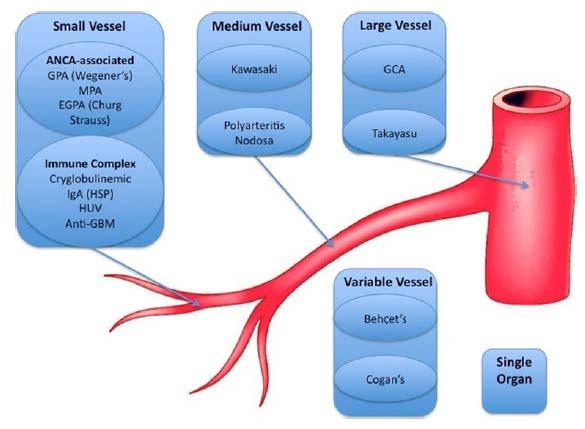 Figuur 3 De verschillende groepen van vasculitis, onderverdeeld volgens de grootte van bloedvat dat wordt aangetast.