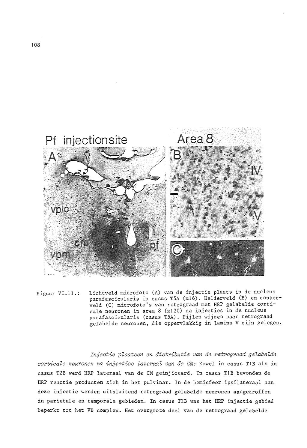 108 Pf injectionsite Area8 Figuur VI. II.: Lichtveld microfoto (A) van de injectie plaats in de nucleus parafascicularis in casus T5A (xl6).