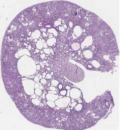 Diermodel voor ADPKD (PKD2) ARPKD nephronophtisis