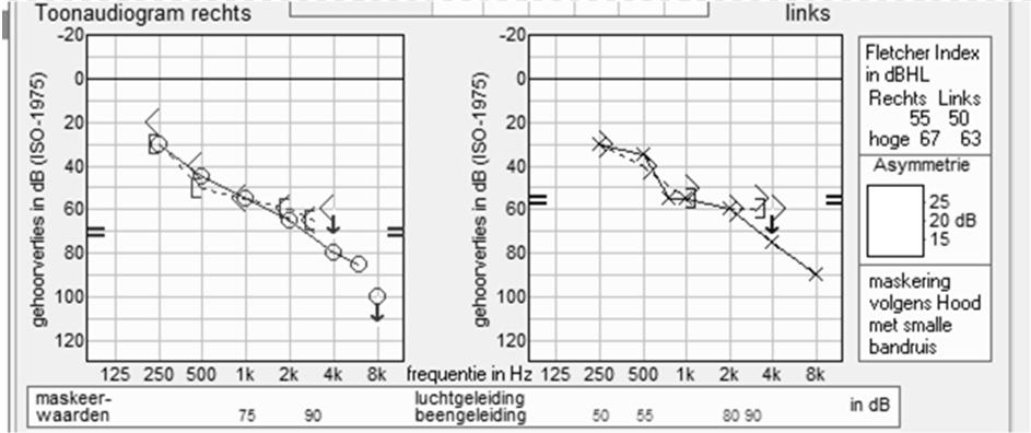 Stap 1d: Effect venting op