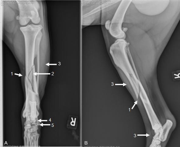 Figuur 7: Pre-operatieve craniocaudale (A) en mediolaterale (B) radiografieën van tibia/fibula: diafysaire fractuur van tibia (1) met trapezoïdaal fragment (2), weke-delenzwelling (3), overlangse