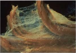Anderzijds is er het fasciale weefsel waarover de Bowen moves gemaakt worden. Fascie is het weefsel dat rondom spieren, pezen, organen, spiervezels, bloedvaten en zenuwbanen loopt.