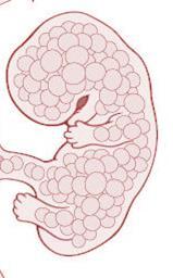 Meestal placenta = foetus +21