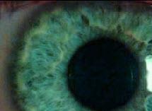 De pupil De pupil is een gaatje wat varieert van 1 tot 7 mm Bij een