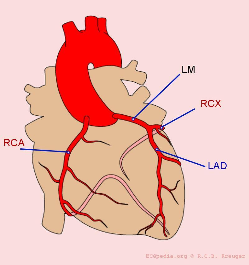 De coronair arterien RCA: rechter coronair arterie LM: left main,