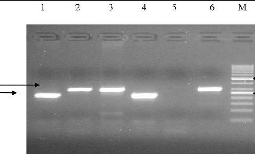 Moleculaire biologie Detecteren van fusiegenen tgv chromosomale translocaties BCR BCR-ABL ABL BCR-ABL BCR