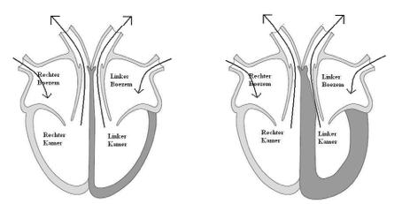 bloed slechts één richting op kan stromen. Boven in de rechter boezem (in de sinusknoop) ontstaat de elektrische prikkel die de spiercellen in het hart laat samentrekken.