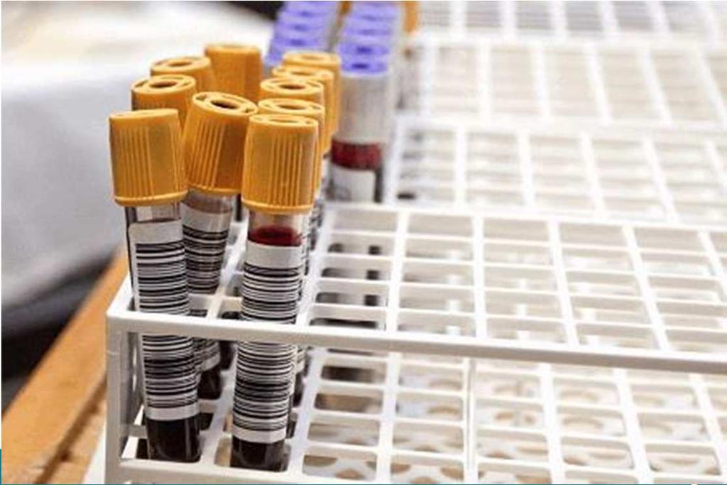 Nieuwe diagnostische ontwikkeling: liquid biopsies Bloedonderzoek om