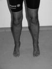 Oefenen en versterken van de spieren rondom de enkel Ga met beide voeten op de grond staan en buig door beide knieën, totdat de knieën in een hoekstand van 90 graden of nog verder tot in hurkstand