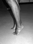 PATIËNTENINFORMATIE Oefenen coördinatie, versterken van spieren rondom de enkel Ga met beide voeten zo hoog mogelijk op de tenen staan en dan weer op platte voeten.