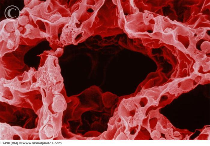 Alveoli Geschat aantal op 300-500 miljoen Geschat oppervlakte