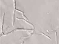 Phytophthora infestans: groei van mycelium Anton de Bary (1831-1888) grondlegger van de mycologie Groei en sporulatie in aardappelblad Groei en sporulatie in petrischaal verrot en verdord