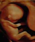 IVF-zwangerschappen Oorzaken en gevolgen van een afwijkende groei in de baarmoeder Invloed van de placenta op de gezondheid van