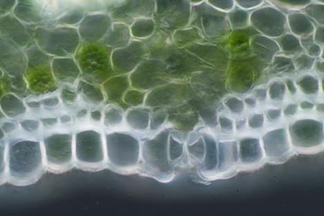 13 Beide volgende foto s tonen huidmondjes. Gemaakt met 400 x microscoop vergroting. Huidmondjes dienen voor de ademhaling van de plant en liggen meestal in de onderzijde van de bladeren.